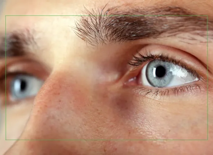 The Latest Advancements in LASIK_ What You Need to Know