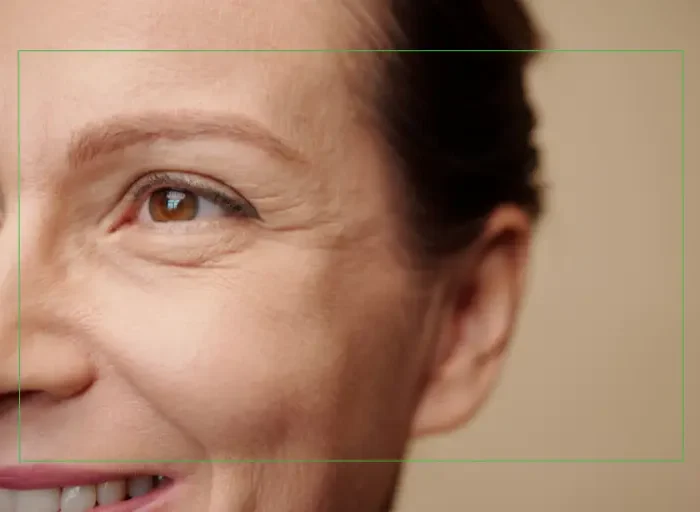 Everything You Need to Know About Cataract Surgery